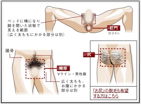 脱毛